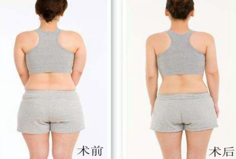 杭州哪家祛痘醫(yī)院好？綜合評(píng)測(cè)幫你選擇！