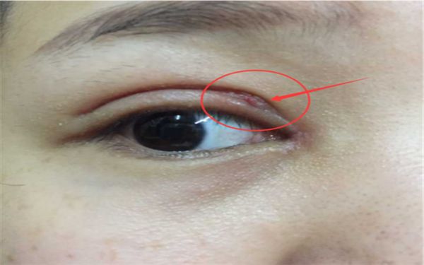 蘇州隆胸哪家醫(yī)院好？專業(yè)醫(yī)師為您分析