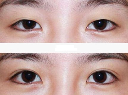 廣州整容鼻子技術(shù)排名前列的醫(yī)院有哪些？