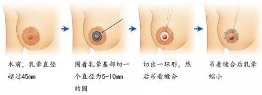 在哈爾濱做除皺哪家醫(yī)院好？選擇專業(yè)除皺醫(yī)生，享受高質(zhì)量護(hù)理服務(wù)
