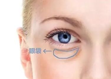 蘇州哪家醫(yī)院治療黃褐斑效果好？