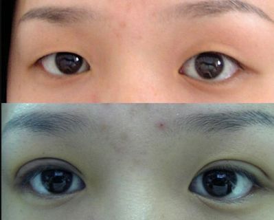 唐山哪家鼻子整形醫(yī)院好？權(quán)威專家為您解答