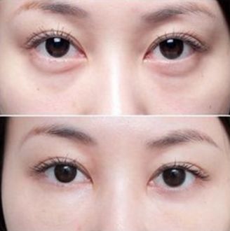 杭州厚唇變薄醫(yī)院哪家好？
