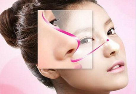 深圳駝峰鼻矯正哪家好？專業(yè)醫(yī)生推薦與真實案例分享！