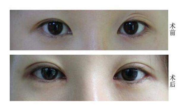 桂林有哪些去痘療效好的醫(yī)院值得推薦？