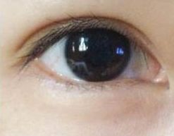 蘇州哪家祛痘醫(yī)院好？專家推薦的治療痘痘效果好的醫(yī)院
