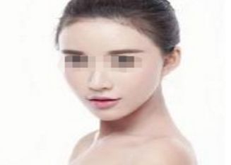 雙眼皮手術矯正寬度方法探秘
