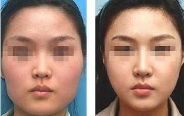 如何改善圓臉型，輕松塑造瓜子臉？五個(gè)有效技巧揭秘！