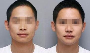 擁有瓜子臉特點的人有哪些？