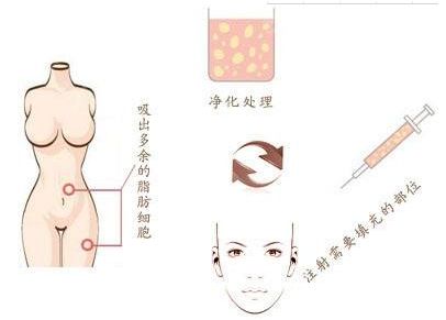 神奇超聲波，消除黑眼圈的實(shí)惠高效方式揭秘