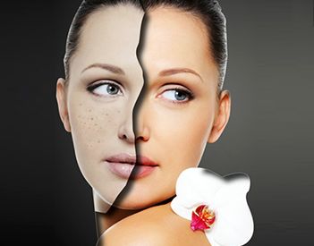 北京雙眼皮修復(fù)的效果如何？什么狀況需要做雙眼皮修復(fù)？