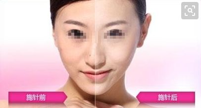耳朵重塑技術(shù)是否優(yōu)質(zhì)？整形手術(shù)費(fèi)用如何評(píng)估？
