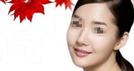下巴整形手術(shù)有哪些方法？下頜角整形是否安全？