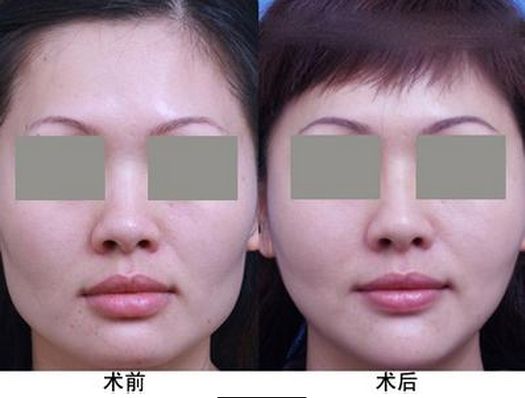 生姜洗發(fā)水哪個牌子好用，一線大品牌值得推薦