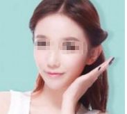 孫儷的容顏變化引發(fā)熱議，她真的進(jìn)行了整容嗎？