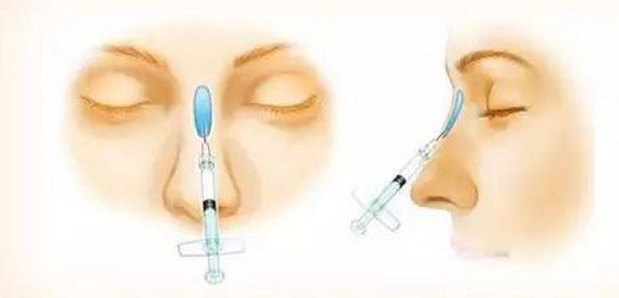 美白祛斑的方法有哪些？4種醫(yī)美美肌方案推薦