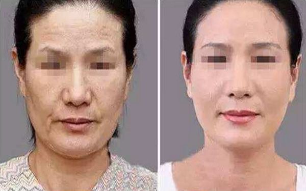 如何讓幼態(tài)臉變得緊致有型？塑造迷人圓潤(rùn)臉型攻略揭秘！