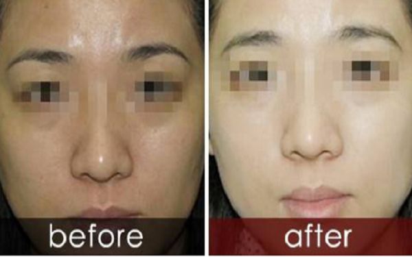 曬黑后如何迅速變白？曬黑美白需要持續(xù)護(hù)理多久結(jié)果可見(jiàn)？了解曬后護(hù)膚科普！