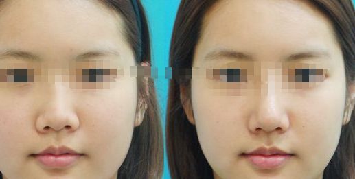 紀(jì)輝私人制造設(shè)備，安全可靠嗎？