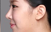 東莞第五人民醫(yī)院美容科綜合評(píng)價(jià)及專家推薦！