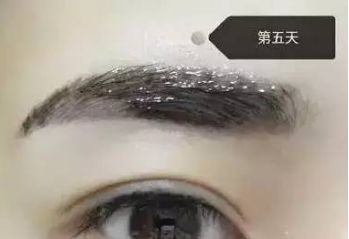 南昌美伊爾劉立軍醫(yī)生膨體隆鼻整形費用？手術(shù)效果如何？帶您看醫(yī)生案例
