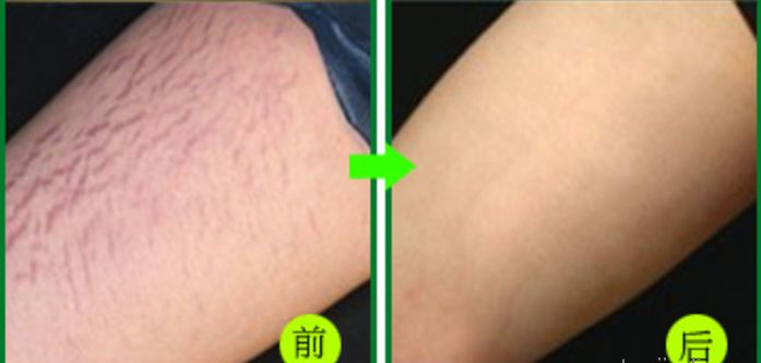杭州地道整形好醫(yī)院推薦，當(dāng)?shù)鼐用窳λ]的高水平醫(yī)療機(jī)構(gòu)