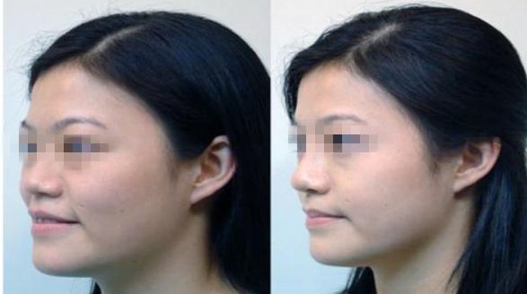 濟南市哪家整形醫(yī)院正規(guī)專業(yè)？推薦可靠的名單