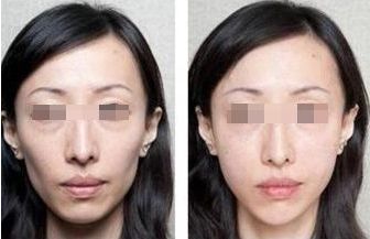 北京頂尖整形醫(yī)院排行榜公布，這三家實力過硬