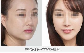 2024年昆明哪家整形醫(yī)院更受歡迎？你一定不知道！