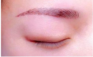 深圳醫(yī)生劉冰的鼻子整形效果如何？專業(yè)實(shí)力及成功案例發(fā)布