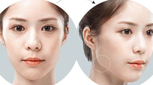 南京乳房美容醫(yī)院推薦，頂級(jí)醫(yī)療機(jī)構(gòu)推薦閱讀