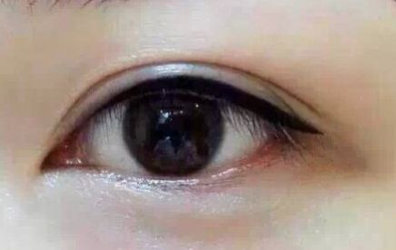 上海9院專家分享軟骨隆鼻案例，LiQingfeng的技術(shù)備受推崇！