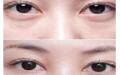云南雙眼皮醫(yī)生排行榜2023：揭秘5位頂尖專(zhuān)家，讓您輕松煥發(fā)雙目魅力！