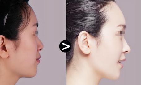 鄭州雙眼皮醫(yī)院綜合排行榜揭曉！權(quán)威榜單揭示雙眼皮醫(yī)療技術(shù)的精髓