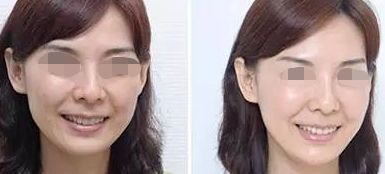 佛山哪家整形醫(yī)院超好的，超皮秒技術(shù)厲害的名單公布
