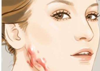 北京哪家醫(yī)院可以洗紋身呢？