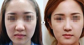 廣州中大光華醫(yī)院，品質(zhì)獲GL國際認證，真實患者評價分享
