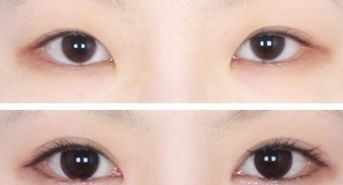 廣州韓后許滿萍醫(yī)生的專業(yè)領(lǐng)域揭秘，令人驚喜的嫩膚案例分享