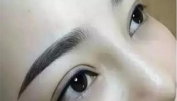 重慶曹陽的鼻子整形效果如何？醫(yī)生手藝獨步天下的真實案例分享