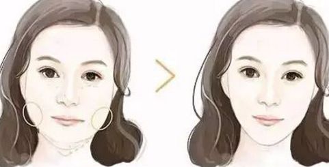廣州拉皮手術(shù)哪里做效果好？華美、曙光等知名醫(yī)院上榜！