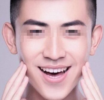北京治疤痕手術(shù)哪家醫(yī)院好？
