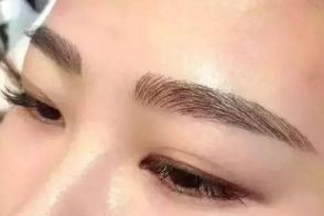 絕佳效果！體驗成都周維開刀雙眼皮的精彩案例