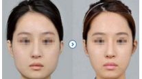 【2024】杭州十大值得信賴的整形美容醫(yī)院推薦！