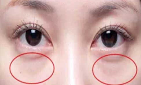 哪位醫(yī)生在八大處能夠?yàn)槟龀鐾昝赖碾p眼皮手術(shù)？手術(shù)價(jià)格信息附后