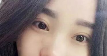 杭州最受贊譽的整容醫(yī)院整形手術(shù)效果揭秘 杭州最受贊譽的整容醫(yī)院整形手術(shù)效果揭秘