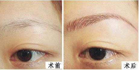 上海九院整形外科醫(yī)生排名新鮮發(fā)布！3位專家各具特長！