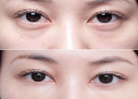 北京最受歡迎的整形醫(yī)院排名高居前三！私立醫(yī)美實力超越公立醫(yī)院！