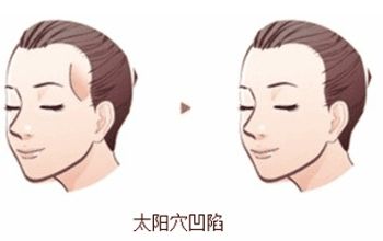 蘇州美貝爾與美萊：隆鼻比較！價格與特色對比！