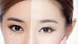 獨(dú)家揭秘！了解重慶楊武林醫(yī)生的墊下巴整形全過程