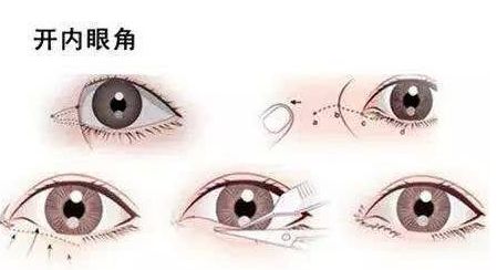 北京哪家專業(yè)醫(yī)院提供高水平的拉皮手術(shù)服務(wù)？權(quán)威機構(gòu)，口碑一流，高性價比可靠選擇！